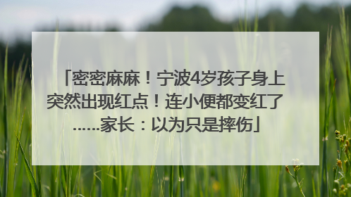 密密麻麻！宁波4岁孩子身上突然出现红点！连小便都变红了……家长：以为只是摔伤